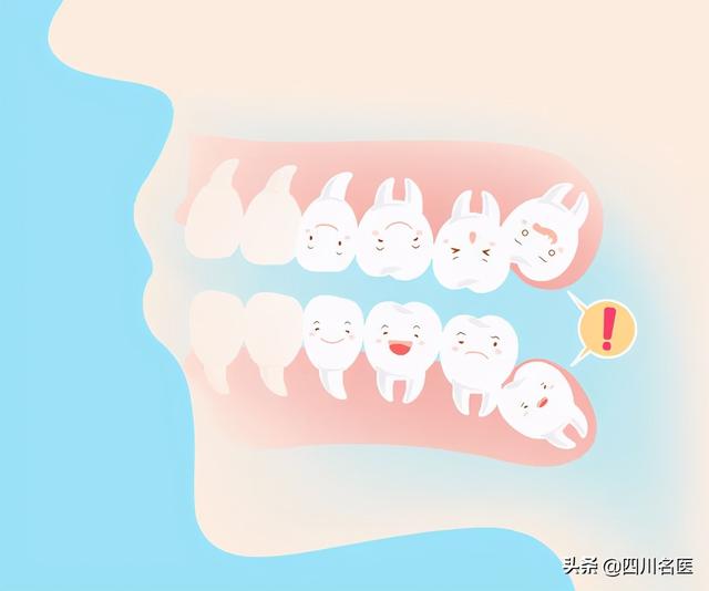 智齿要不要拔看完这篇我瞬间懂了（智齿到底要不要拔）(5)