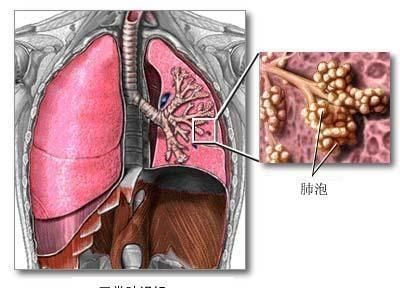 非典确诊人数，非典死亡人数哪个城市最多？图3